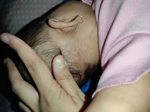 Bintik kecil & merah di kepala bagian belakang