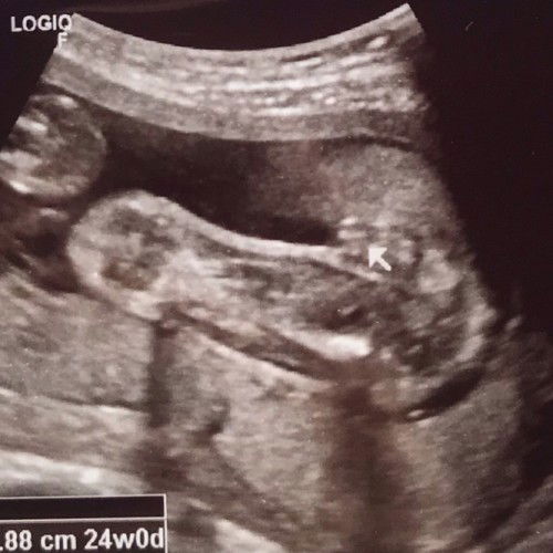 ผู้หญิงมั้ยค่ะแม่ๆ