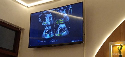 Kata dr adek sehat" 🤍 uda mau masuk panggul, sehat" Ya dek ❤