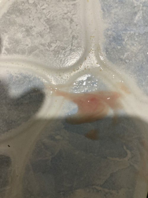 ถามแม่ๆค่ะแบบนี้คืออะไรคะ