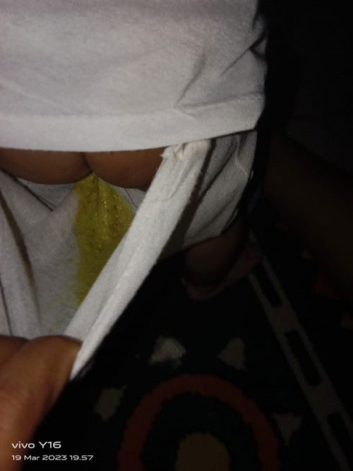 Bayi 6 bulan sering sekali BAB sedikit sedikit
Mohon bagi pengalamannya dan bantu jawab bund,