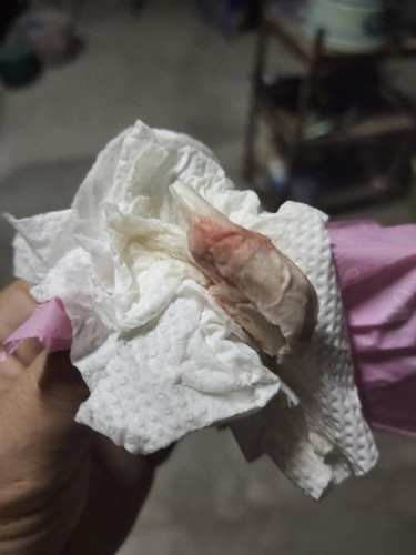 แบบนี้ต้องไปหาหมอมั้ยค่ะ