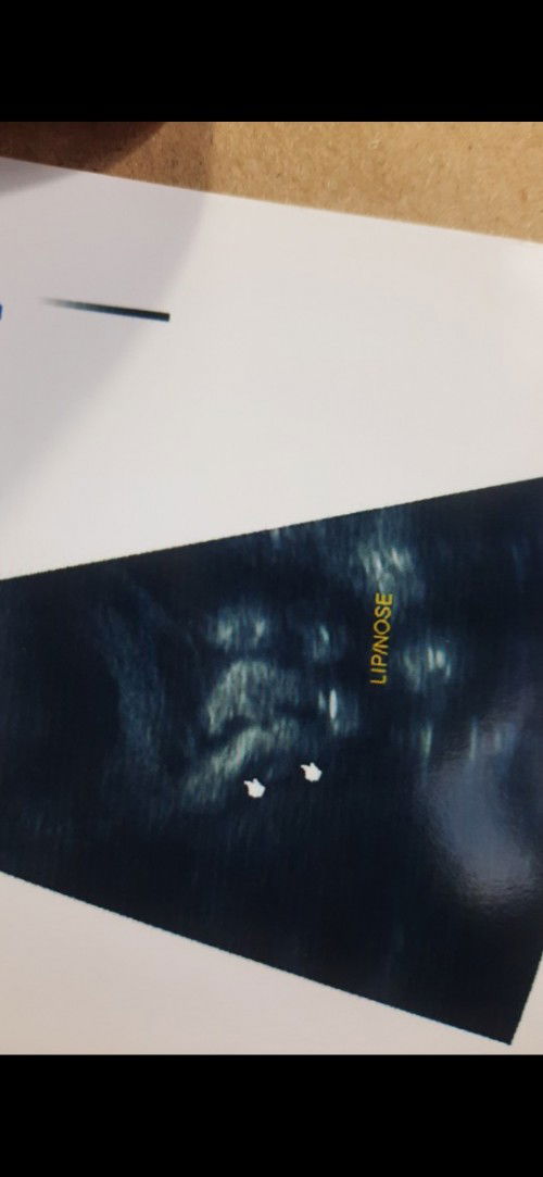 34+6....น้องหนัก 2800