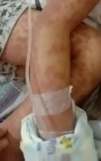 Hi ask lang po sa mga nakaranas sa baby nila ng ganito ano po ang ginawa nyo . Share nyo naman po .