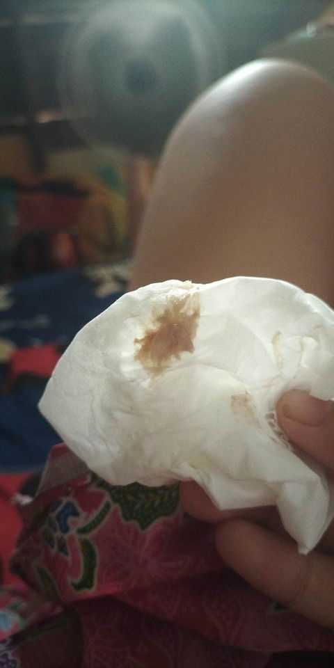 อาการใกล้คลอด