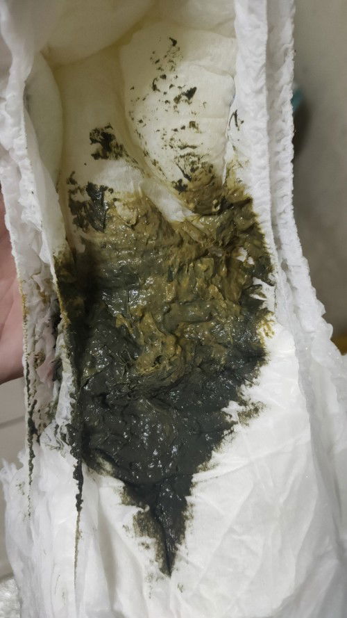 Normal tak najis berwarna ni?