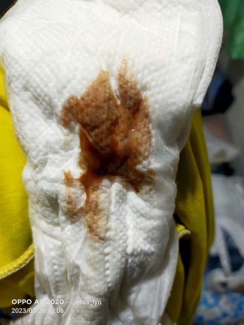 39 weeks 4 days may brown discharge