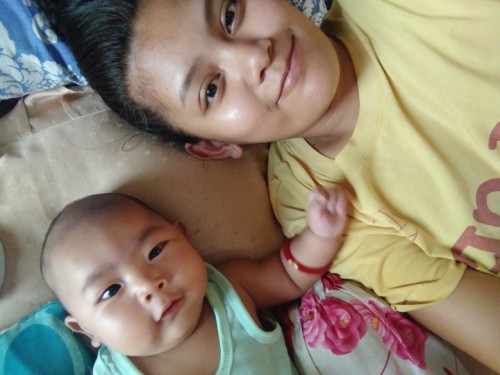 3 months nko nanganak hanggang ngaun nkkapa ko ung tahi ko normal lng ba un na hnd pa nattanggal ??