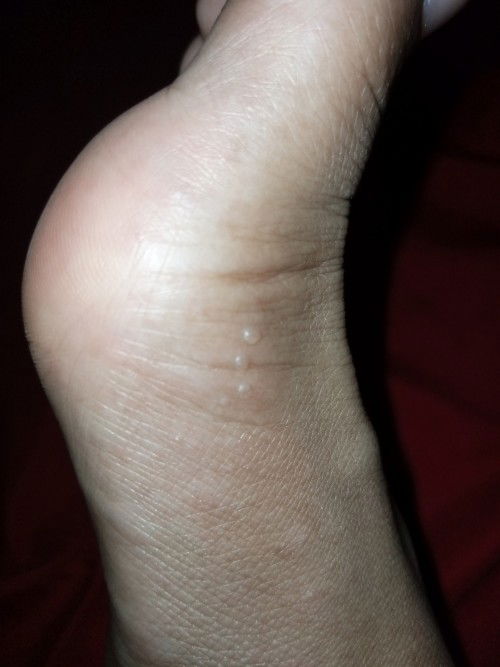 Gatel-gatel apakah bawaan hamil???