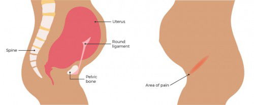 14 weeks (sakit puson at balakang)