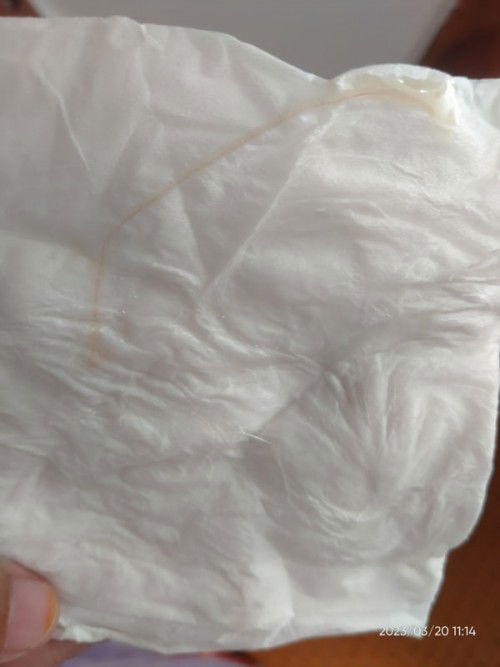 Apakah ini lendir mau melahirkan?