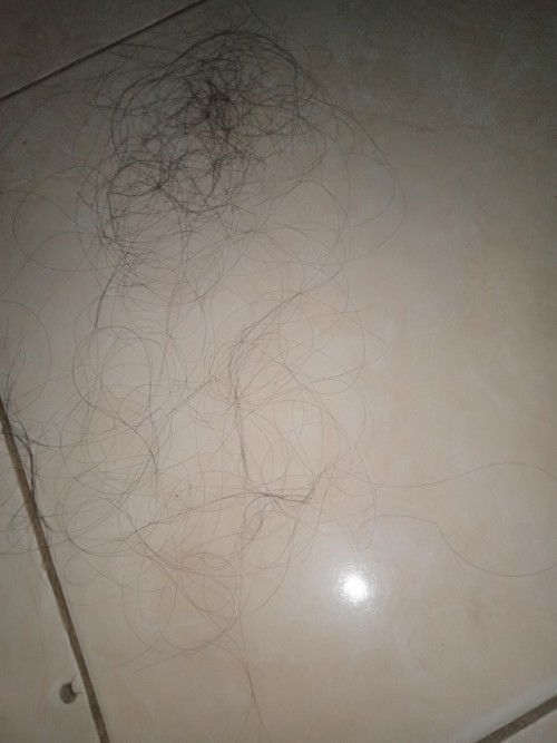 Solusi untuk rambut rontok setelah melahirkan