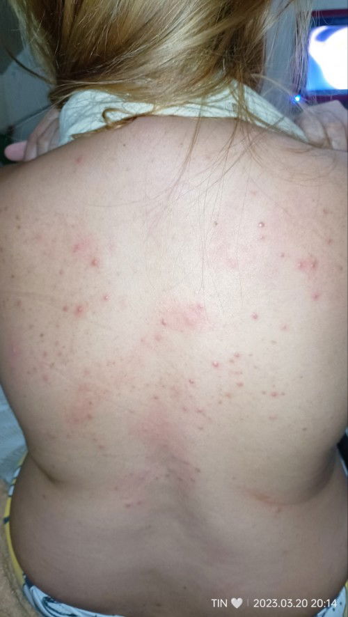 Ano kaya pwede igamot?