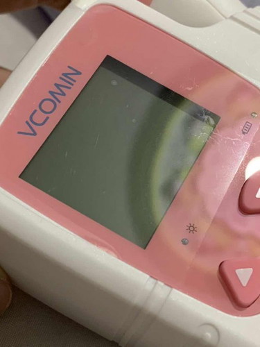 Fettal Doppler