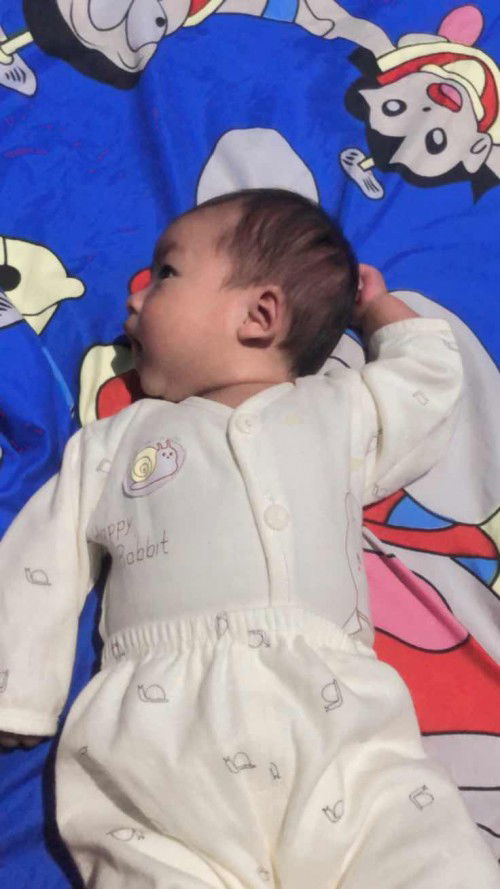 หัวแบนหรือหัวทุย