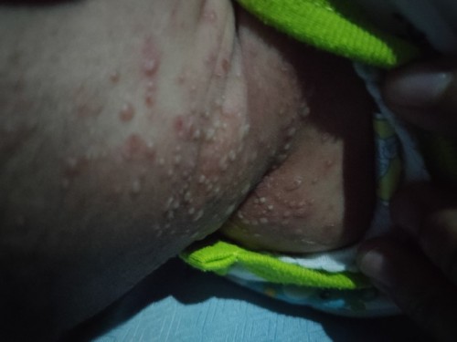 Mohon dibantu mam ini untuk penanganan
