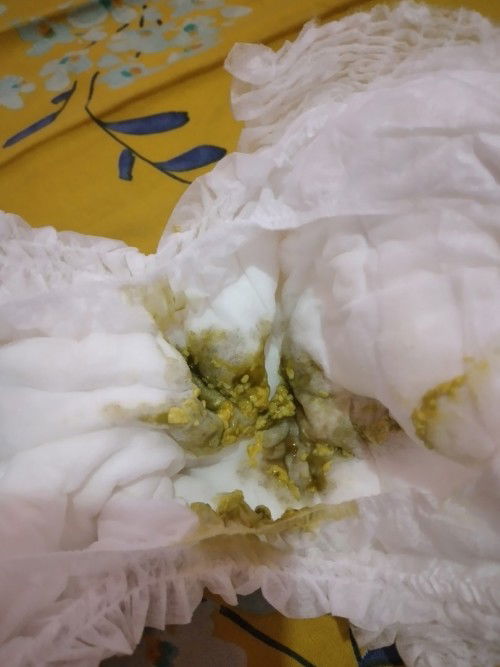 Bayi 5,5 bulan diare