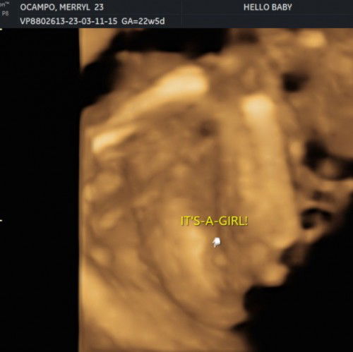 Team July (EDD July 10,2023  )