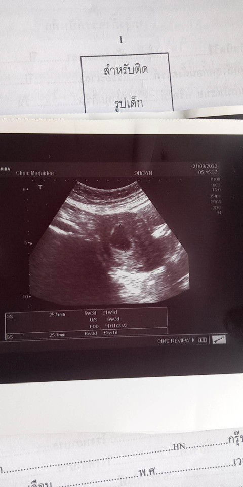 เจอน้องตอนกี่วีคบ้างคะ