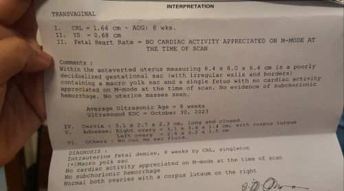 8 weeks no heart beat