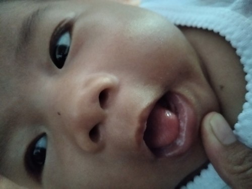 Bibir bayi putih2