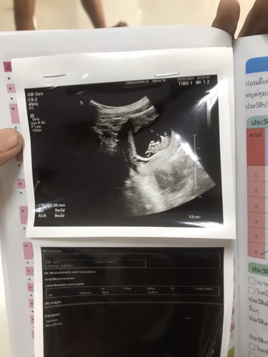 9w6d ถุงกลมๆเหมือนฟองๆคืออะไรหรอค่ะ