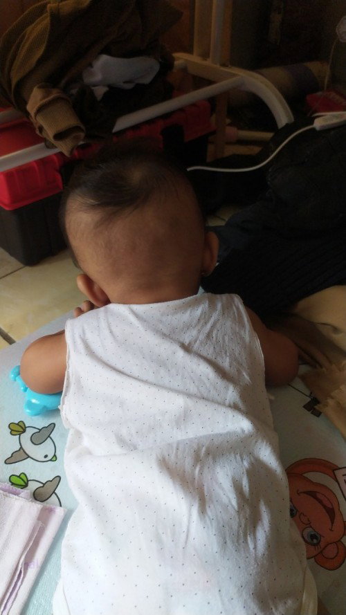 Kepala bayi miring