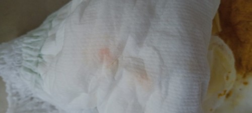 สีของปัสสาวะ