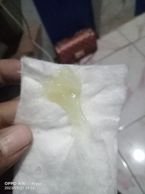 Lewat hpl keluar lendir