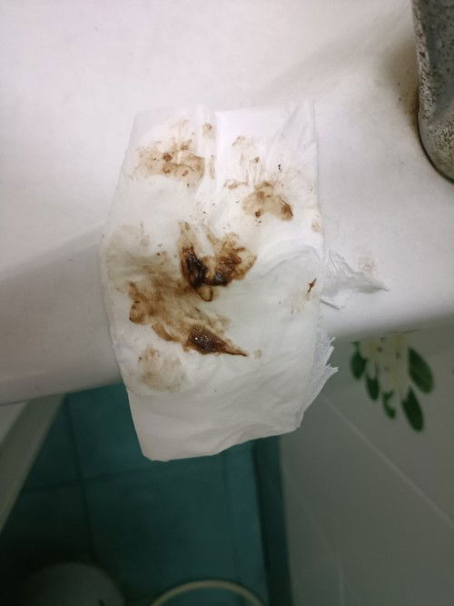 สอบถามแม่ๆหน่อยค่ะเลือดออกสีน้ำตาลอันตรายไหมค่ะ