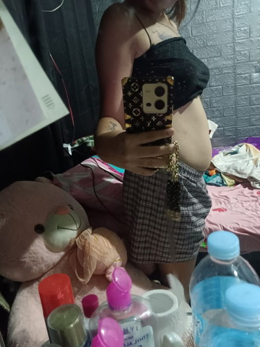 Hello po mga mommy normal lng po tong ganitong size nang tummy para sa 13 weeks?