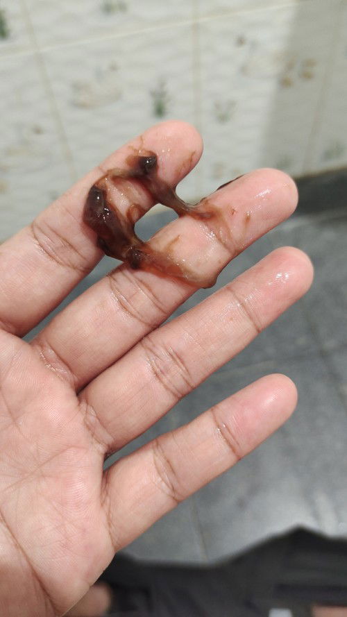 ควรรอหรือไปรพเลยค่ะ