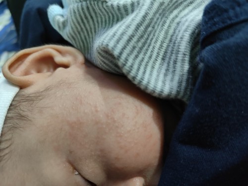Advise on baby's skin condition