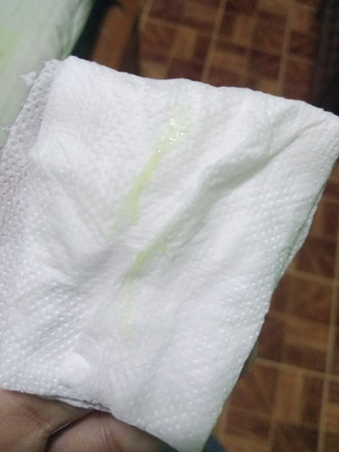 Hello mga mie , normal lang po ba ang ganitong discharge?
Wala naman pong amoy,