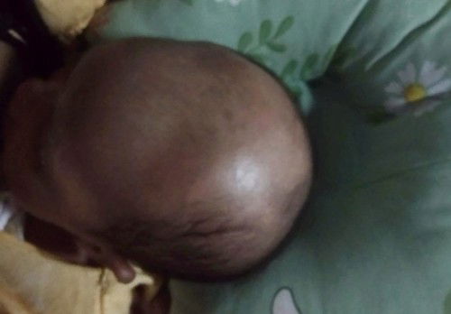 Bun mau tanya ini knpa bayi sya kok rmbutnya rontok terus,  apa normal buat bayi bun?