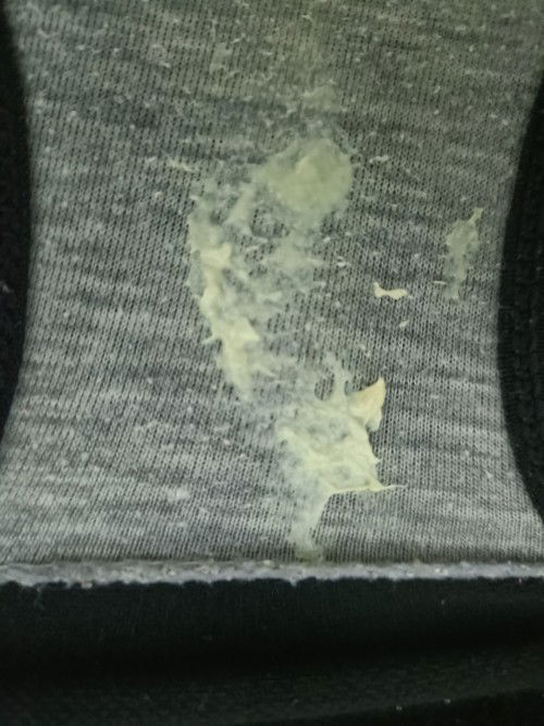 แม่ๆ บ้านไหนมีอาการตกขาวเยอะแบบนี้บ้างค่ะ แล้วต้องไปหาหมอไหมค่ะ อายุครรภ์ 29W 2Day