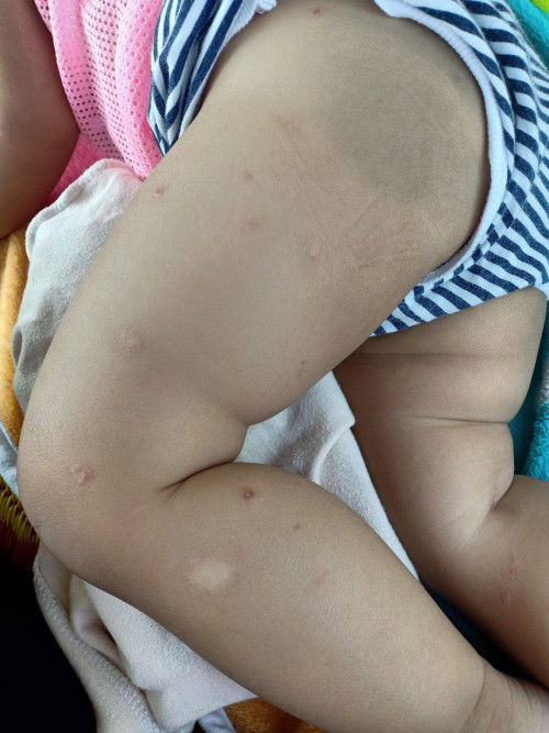 สอบถามแม่ๆ