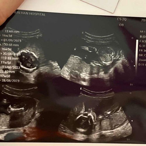 รู้เพศได้ไหมคะ