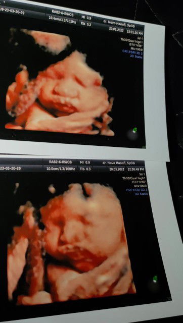 Masyaallah tabarakallah , adek nyaprut 🤣🤭🥰