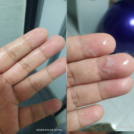 keputihan atau tanda
