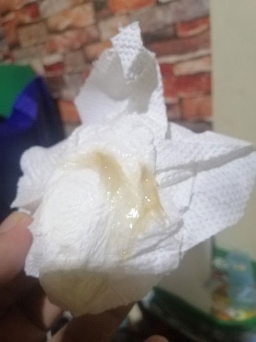 Ano po ito? Mucus Plug po ba? Discharg lang?