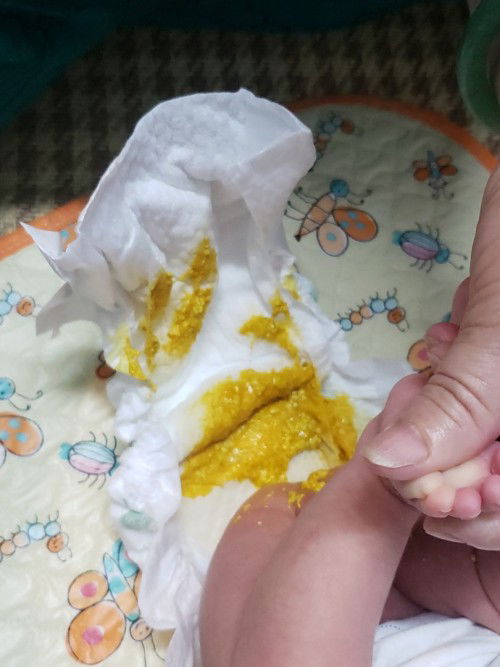 Các mom cho e hỏi phân như này của bé sơ sinh dưới 1th tuổi như này có ổn chưa ạ? Không mùi chua.