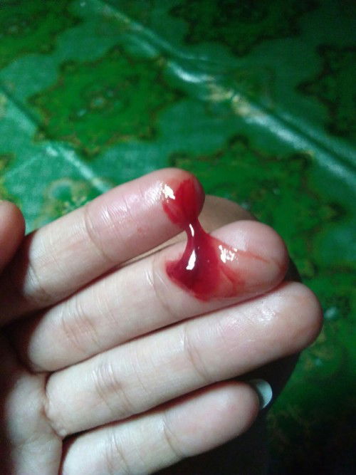 เจ้บท้องถี่แล้วหาย