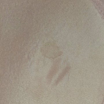 Asi rembes itu seperti apa?