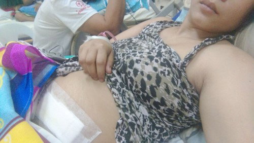 Sino po d2 na. Operahansa appendics habang buntis? #appendectomy kmusta po baby nyo?  16 weeks preg