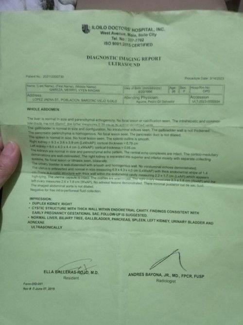 Gestational sac of early pregnancy