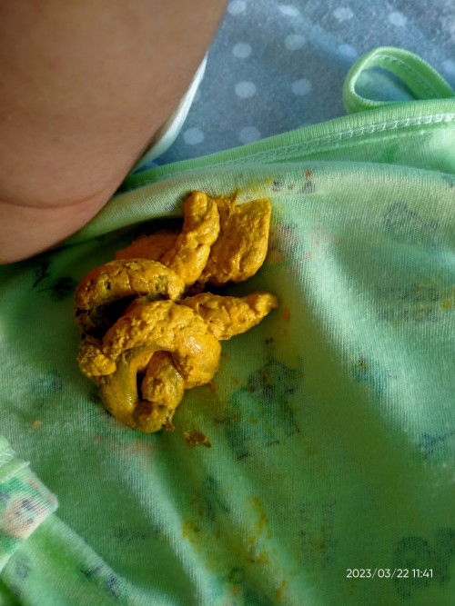 BAB bayi ada warna hijaunya