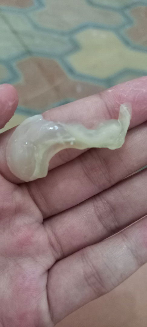 Bun tanya apa keluar lendir termasuk tnda mendekati persalinan?
Pdhl baru 30week