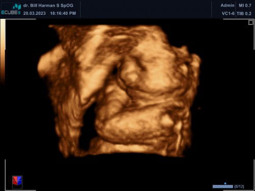 27 weeks 3Day usg 4D