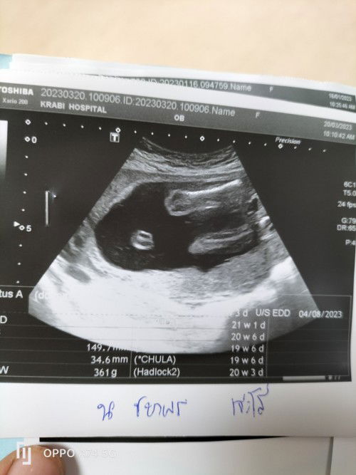 ดูเพศน้องตรงไหนคะ